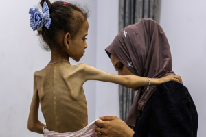 Palestinian Teen Starved to Death in Gaza amid Israeli Aid Restrictions