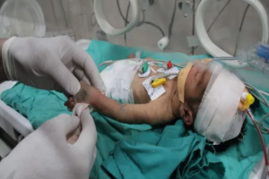 الأمم المتحدة: 14 ألف رضيع مهددون بالموت في غزة خلال يومين