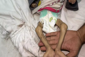 الأمين العام للأمم المتحدة يرفض استخدام الجوع كسلاح في غزة