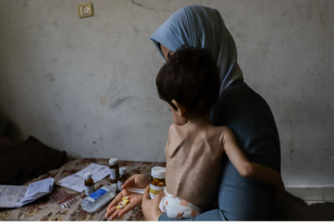 175 Palestinians, including 93 Children, Die of Starvation in Gaza