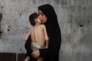 Starvation Claims 185 Lives in Gaza in August, including 12 Children