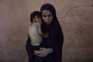مستشفى الشفاء: وفاة 21 طفلًا جراء الجوع في غزة خلال 72 ساعة