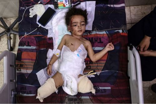 Gaza: 6,000 War Amputees Need Urgent Rehabilitation