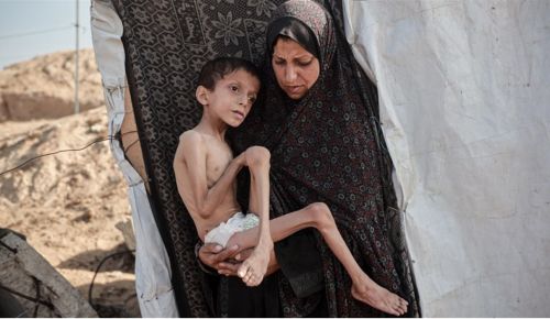 Millions Still Face Hunger & Malnutrition in Gaza, UN Says