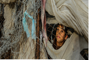 Gaza: Growing Number of Sick and Injured People Are Dying due to Israeli Blockade