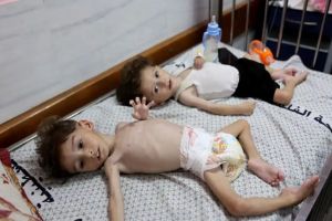  Doctors Warn Starving Gaza Children Could Die ‘Not in Weeks but Days’