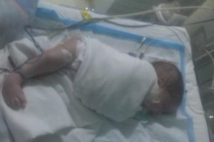    Palestinian Newborn in Need of Urgent Treatment in Lebanon