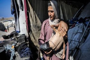 251 Palestinians Killed by Starvation in Gaza Since March