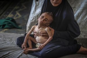 Malnutrition Deaths Mark ‘Latest in War on children’ in Gaza: UN
