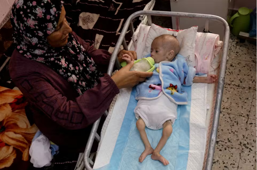 ‘Famine Silently Begins to Unfold’ in Gaza, UNRWA Chief