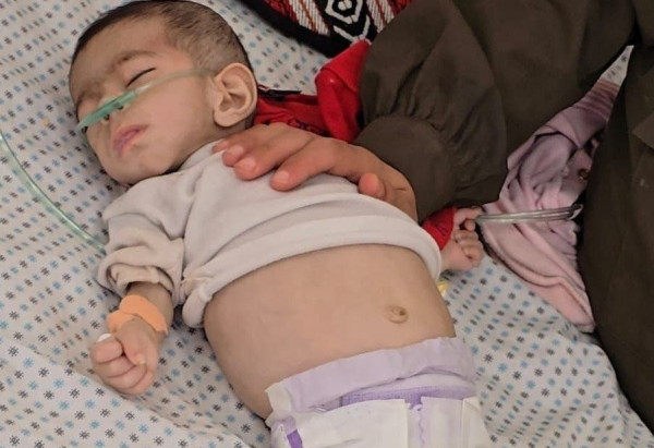 رضيعة فلسطينية تفارق الحياة جوعًا في غزة في ظل الحصار المُطبق